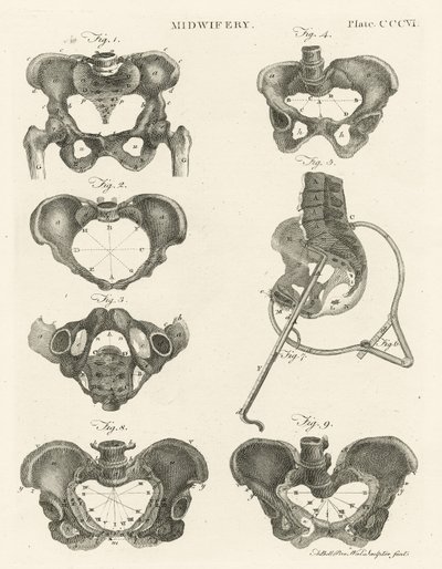 Midwifery, illustration from 